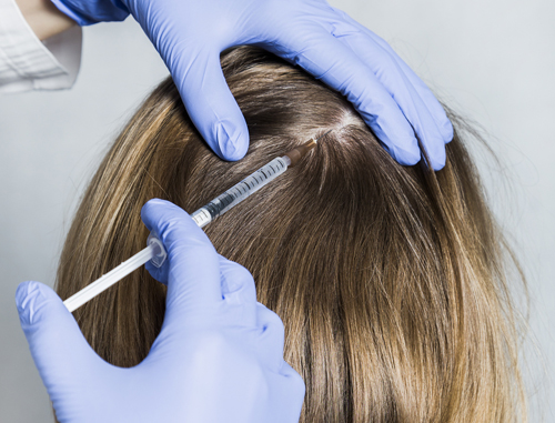 Investeer deze zomer in een gezonde haarbos met Carpe Clinic